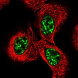 WRN Antibody, Novus Biologicals 0.1mL; Unlabeled:Antibodies, Polyclonal